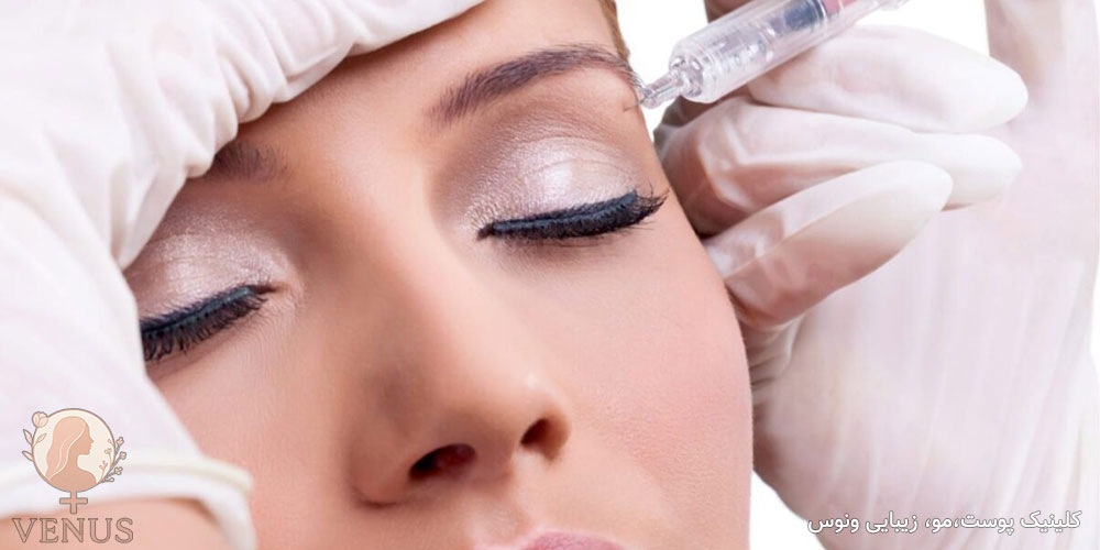بوتاکس چشم گربه ای در فردیس