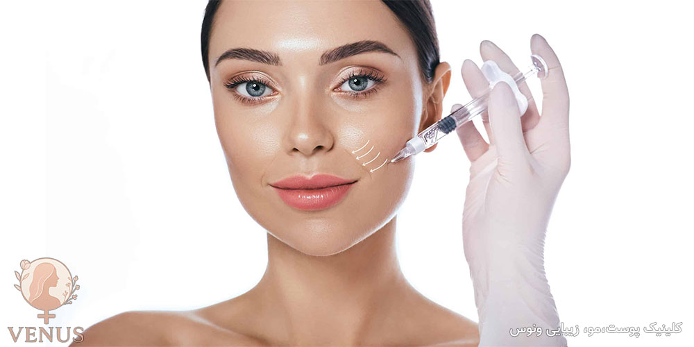 فیلر گونه در فردیس