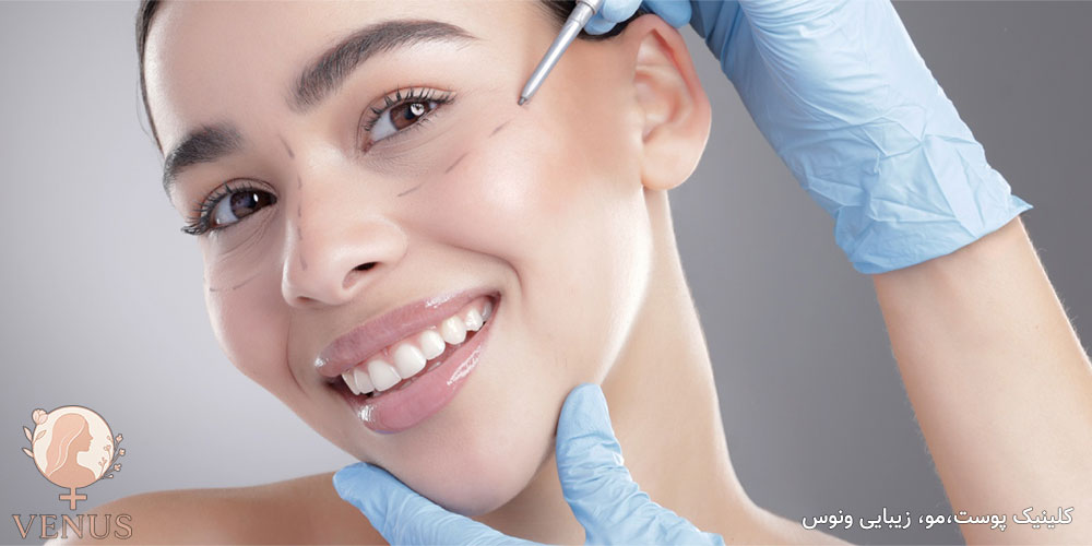 فیلر گونه در فردیس