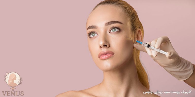 فیلر گونه در فردیس