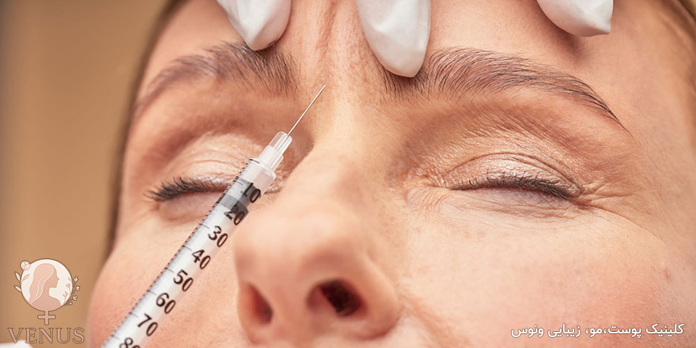 بوتاکس ابرو و خط اخم در فردیس