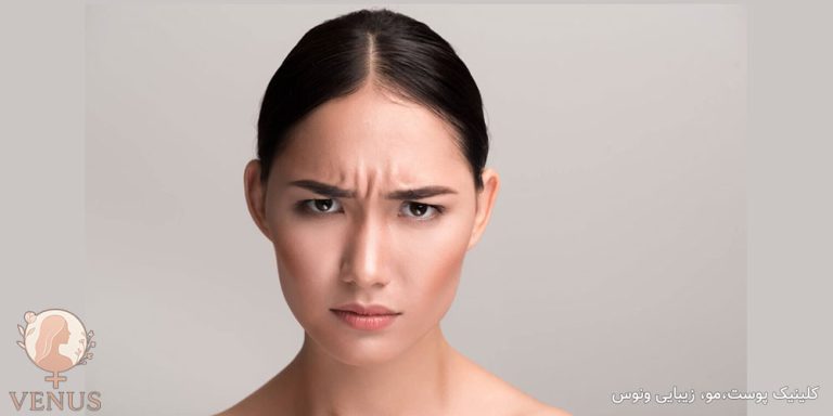 بوتاکس ابرو و خط اخم در فردیس