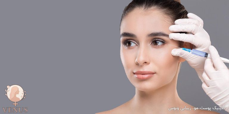 فیلر مادلینگ در فردیس