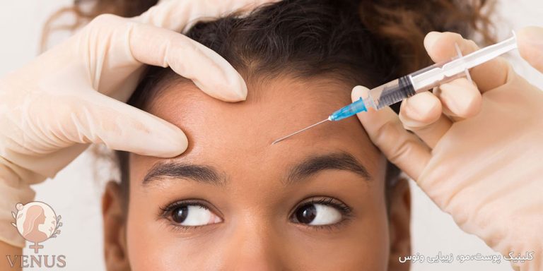 بوتاکس پیشانی در فردیس