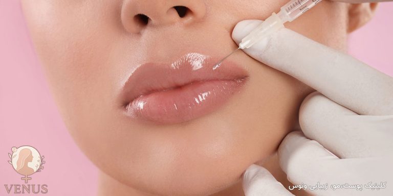 فیلر لب در فردیس